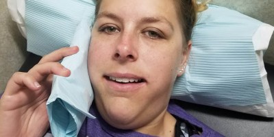 Wisdom teeth out after 30 years old